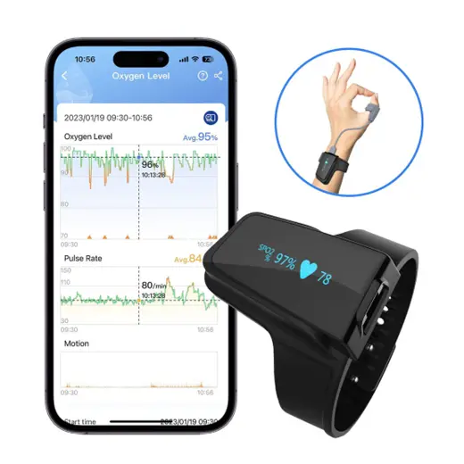 مچ بند پالس اکسیمتر مچی Checkme O2 Max